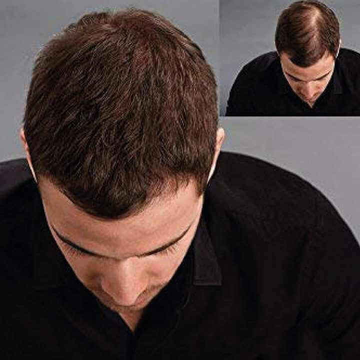 KÖ-HAIR FIBERS 30g Hair Thickener, Hair Fibers, Hair Building Fibers
